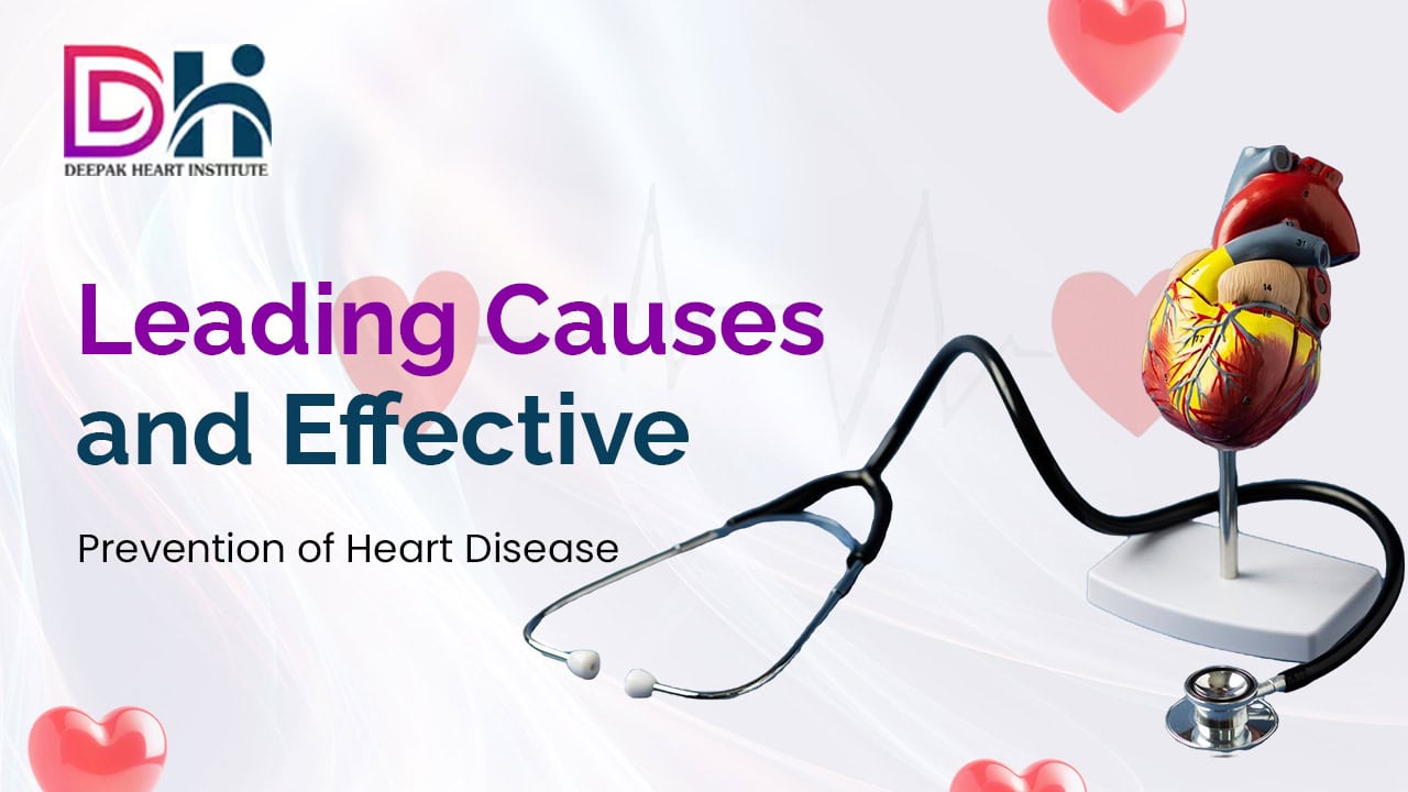 Heart Disease Leading Causes and Steps for Effective Prevention