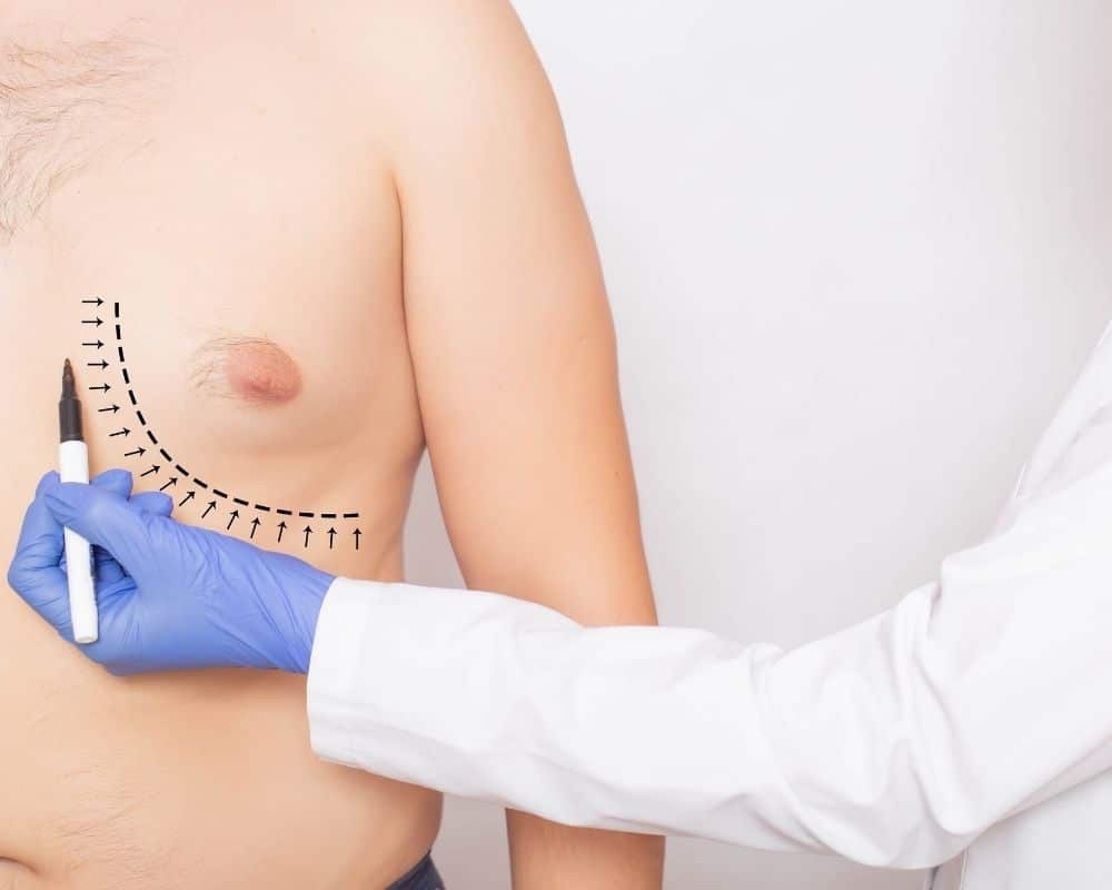 Ginekomastia zabieg - gabinet Gdynia, Gdańsk