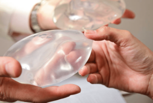 Doskonały implant piersi w klinice Derm-Estetyka w Gdyni.