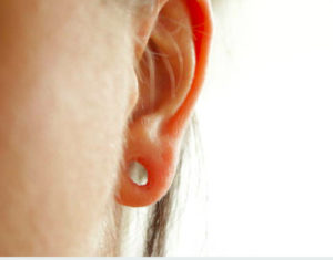 rekonstrukcja płatków usznych po tunelach 