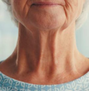 Starość, zmarszczki na szyi, medycyna estetyczna Gdynia.