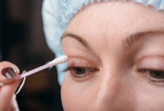 Jak przebiega rekonwalescencja po plastyce powiek górnych i dolnych