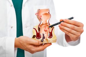 Operacja szczeliny odbytu Gdynia, Gdańsk