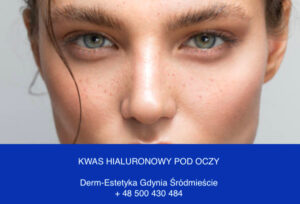 kwas hialuronowy pod oczy