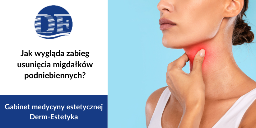 Jak wygląda zabieg usunięcia migdałków podniebiennych?