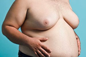 Lipomastia