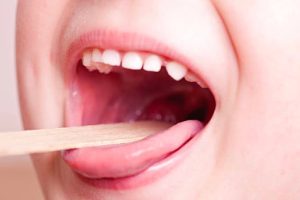 Usuwanie migdałków