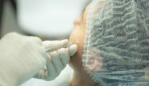 Injection botoks w gabinecie medycyny estetycznej Derm-Estetyka w Gdyni.
