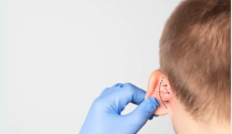 Zakładanie wkładek hearing aids w klinice Derm-Estetyka Gdynia.