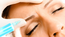 Botox co to jest