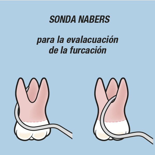 Sonda Nabers Color Code - Imagen 2