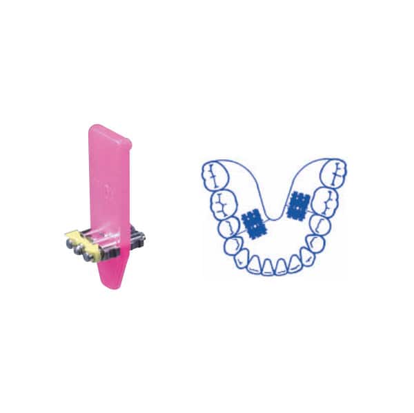Tornillos de expansión Micro Monolateral con Guía en U Recta
