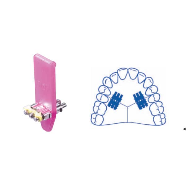 Tornillos de expansión estándar /medio /universal - Imagen 2