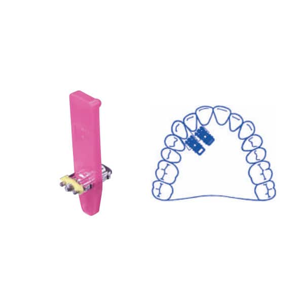 Tornillos de expansión Super Micro Monolateral