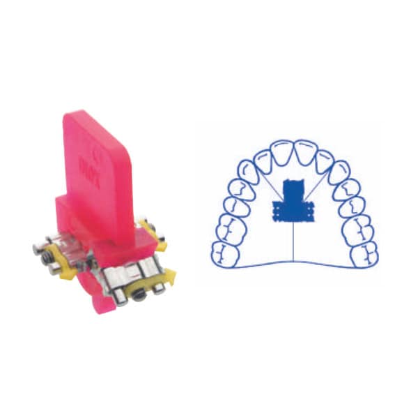Tornillo de expansión tridireccional