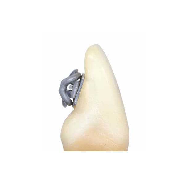 Brackets liguales IDEA-L - Imagen 4