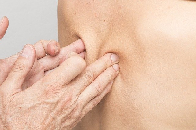 trigger point massage