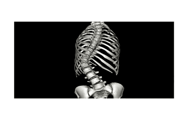 3d spine cuve