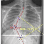 initial curve