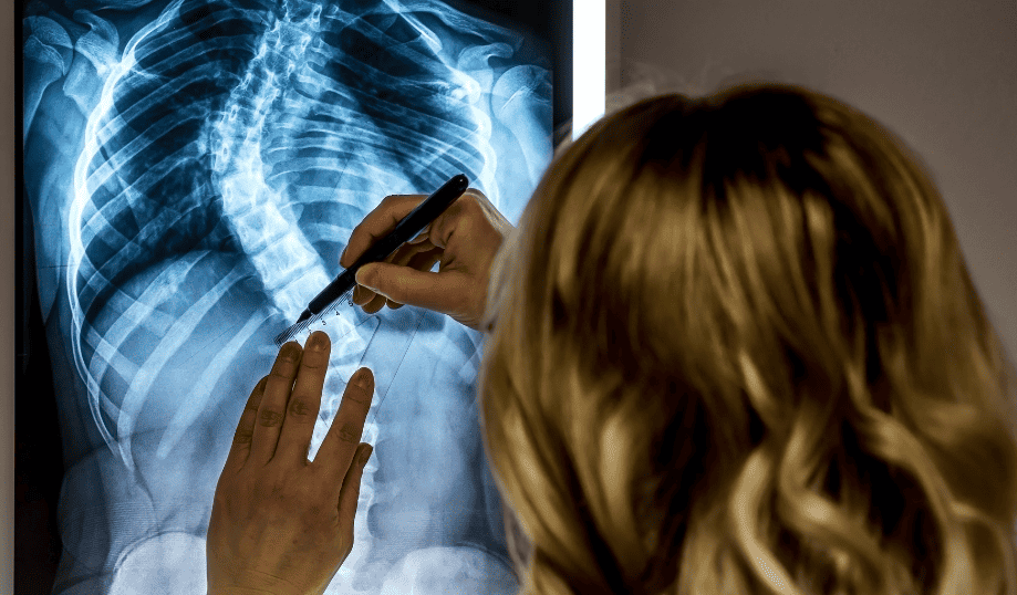 xray view