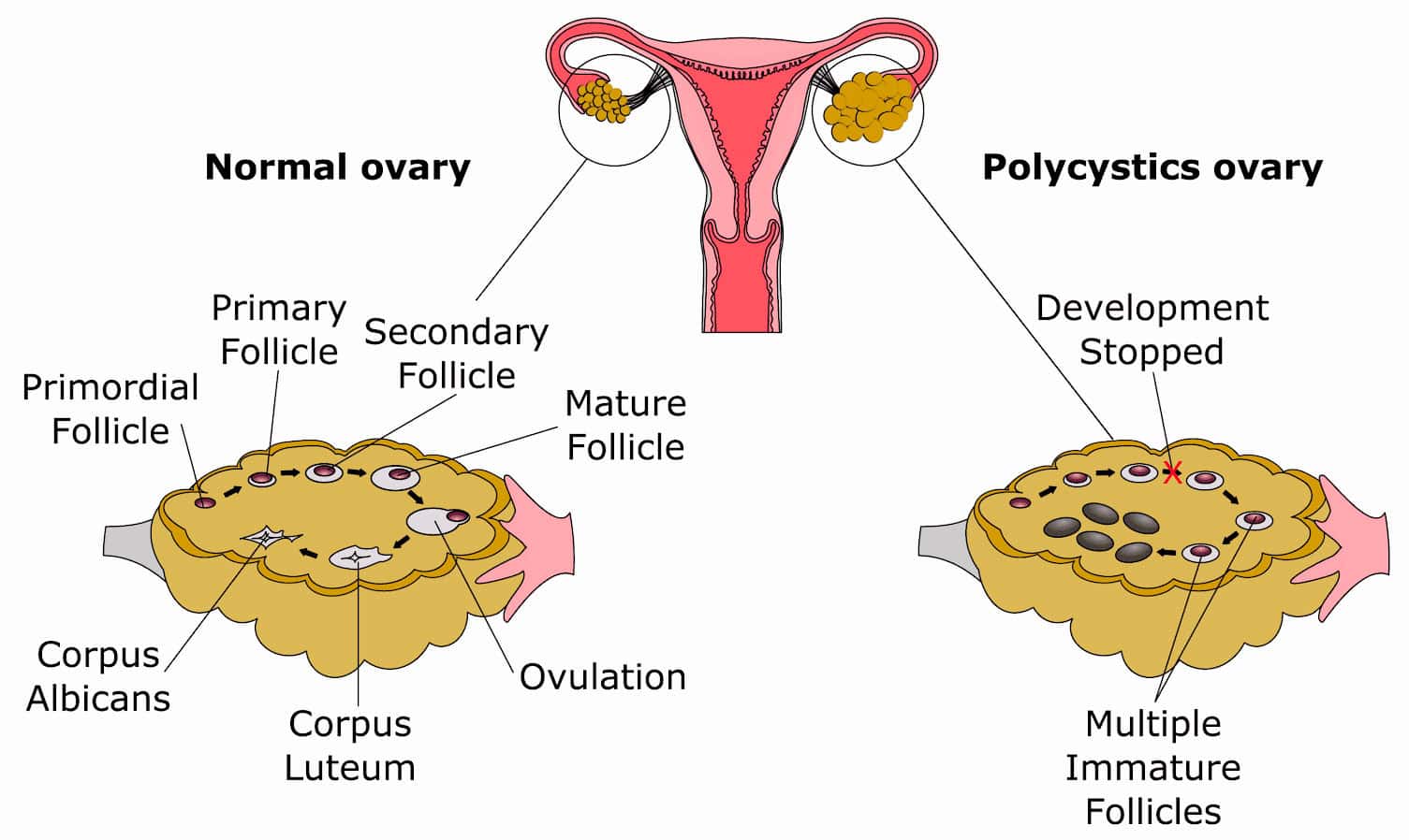 Ovulation and ovary health illustrated for Ayurvedic fertility treatment, PCOS, and reproductive wellness at Sanjivani Ayurved Shala.