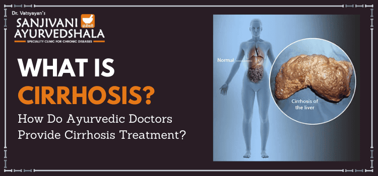 What is Cirrhosis? How do Ayurvedic doctors provide cirrhosis treatment?