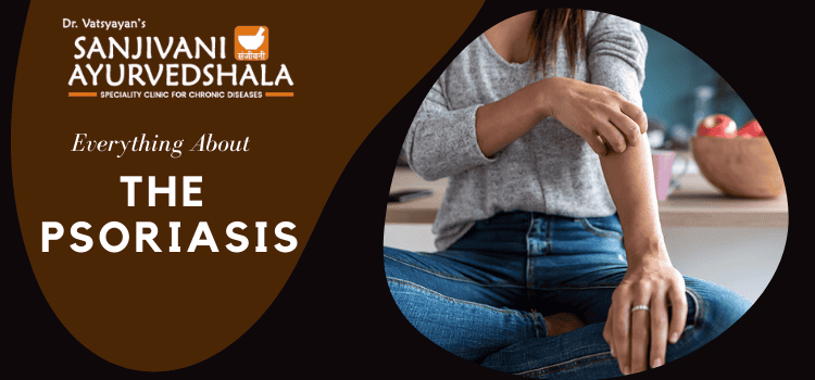 Everything about the psoriasis