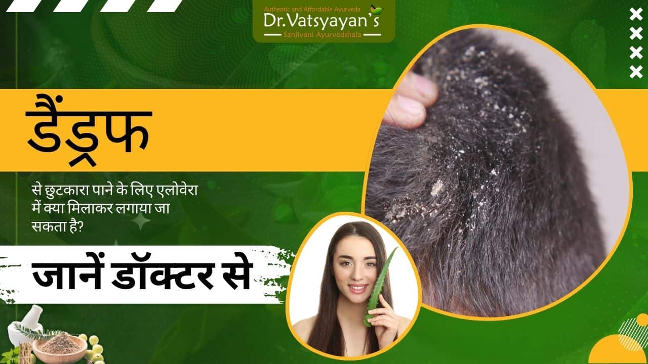 डैंड्रफ से छुटकारा पाने के लिए एलोवेरा में क्या मिलाकर लगाया जा सकता है? जानें डॉक्टर से
