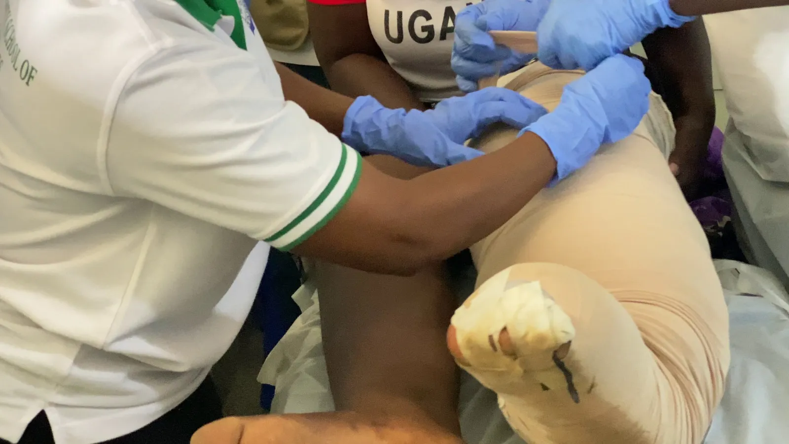 edema-support-foundation-images4
