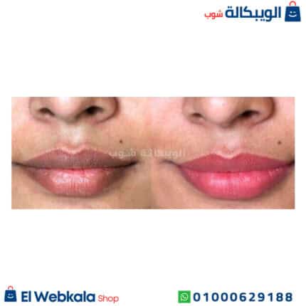 فازلين وردي للشفايف