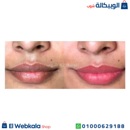 فازلين وردي للشفايف