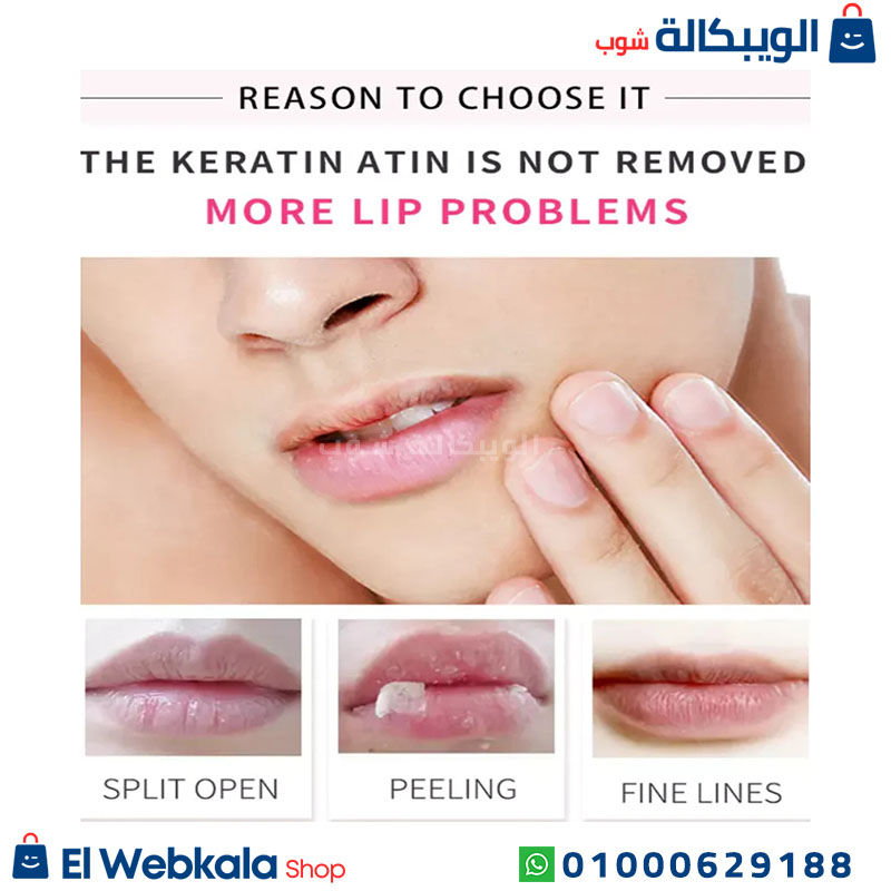 Estelin Peach . مرطب شفاه طبي استيلين