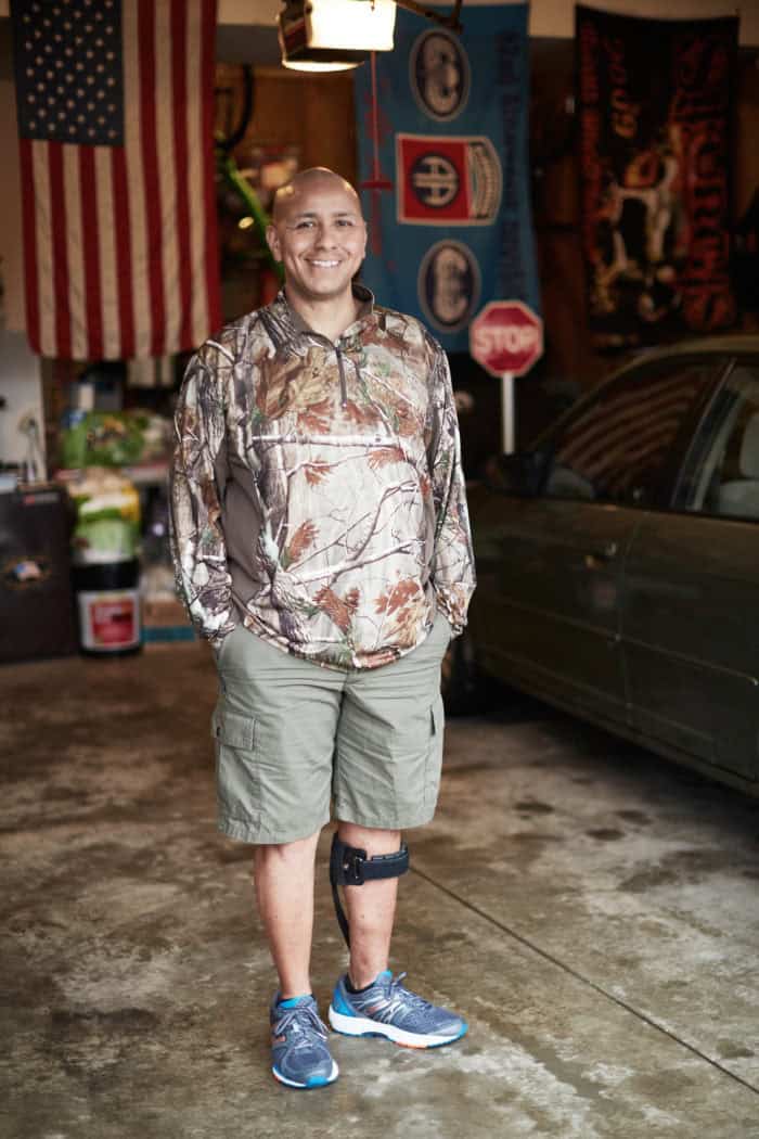 Smiling man with leg brace standing