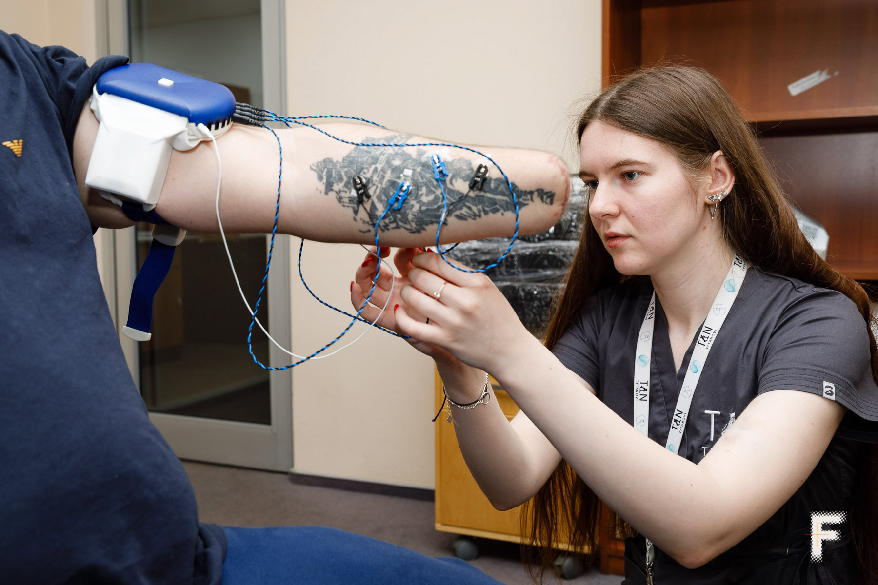 Ghosts of the past – how the brain refuses to let go of lost limbs