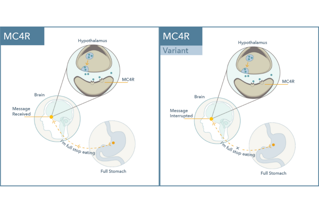 MC4R and MC4R Variant