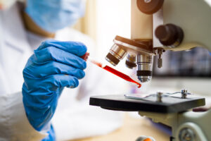 lab technician putting red droplet under microscope for precision health and genetics for heart medications