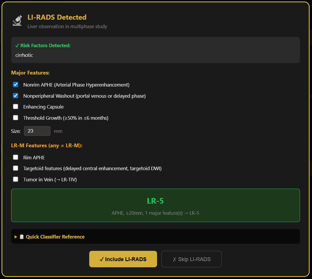 סיווג LI-RADS המופיע בחלון קופץ, המזוהה אוטומטית מתוך תמלול של נגע בכבד ב-GigHz Precision AI.