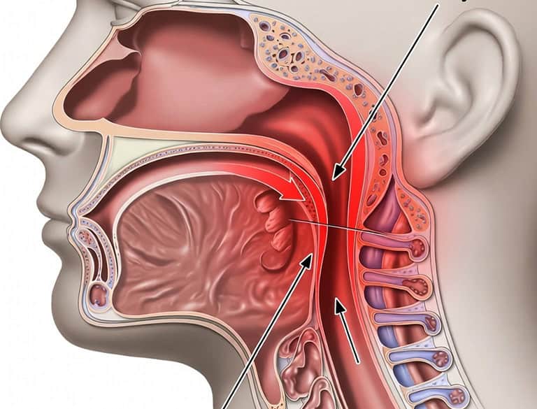 Detailed diagram of the throat and esophagus showing swallowing process.