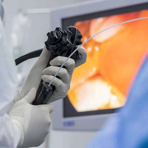 Endoscopic medical procedure with a flexible scope and monitor display.