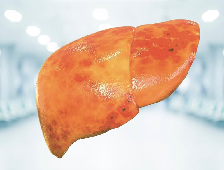 Healthy liver illustration for fatty liver disease awareness.