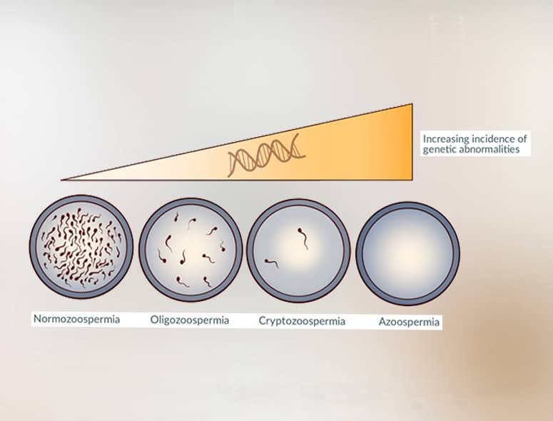 Diagram showing increasing genetic abnormalities in sperm development stages.