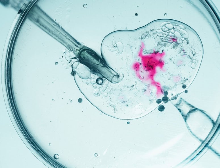 Fertility treatment process with sperm and egg in laboratory setting.