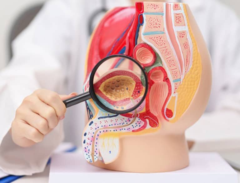 Detailed anatomical model of male reproductive system with magnified testicle.