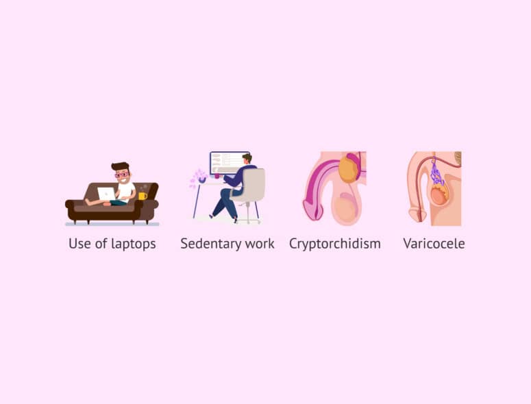 Illustration of male infertility factors including sedentary work and varicocele.