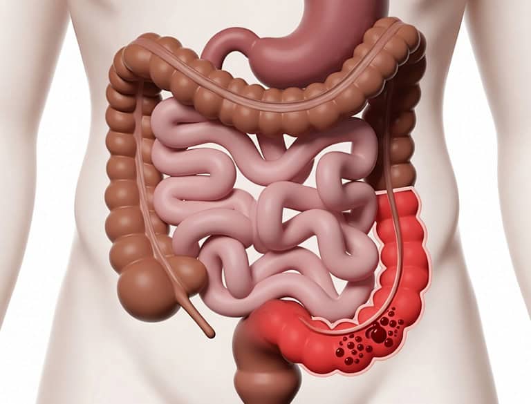 Detailed illustration of human digestive system highlighting intestines.