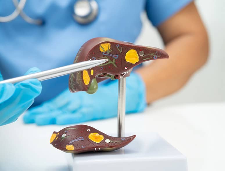 Model of a human liver with colored sections showing different liver parts.