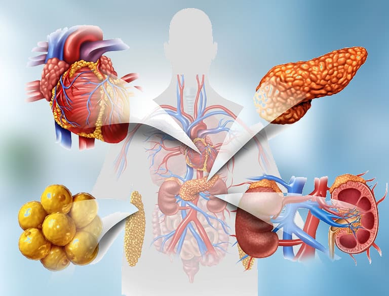 Illustration of reproductive organs and related conditions linked to recurrent miscarriage.