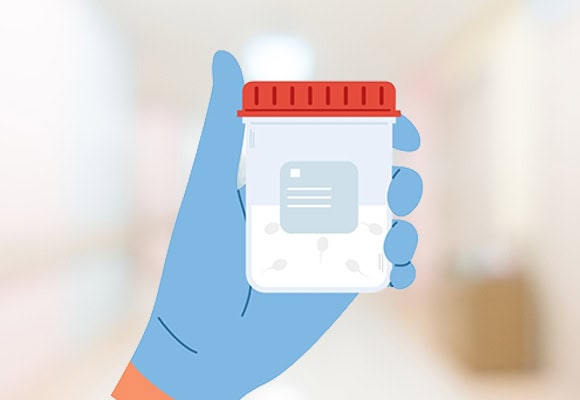 Medical sample container held in a gloved hand for fertility testing.