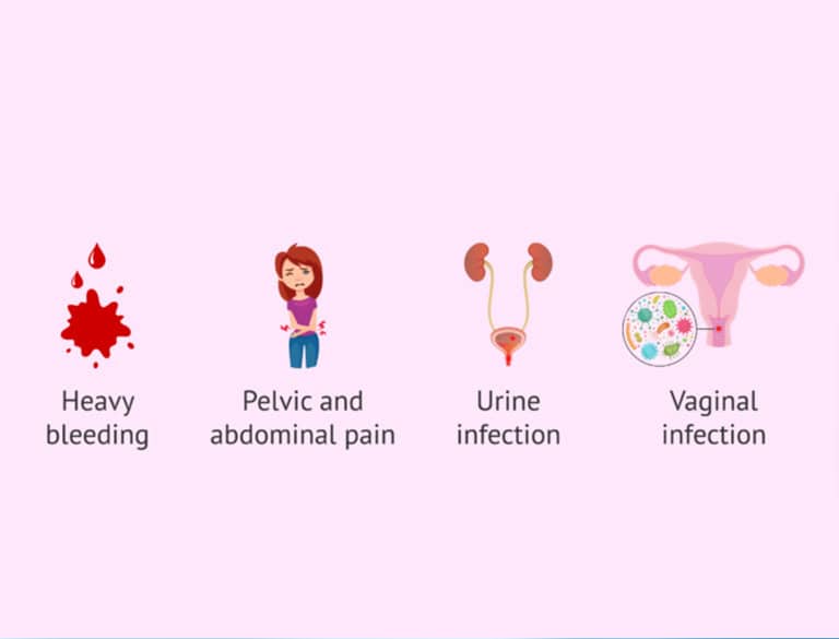 Symptoms of recurrent miscarriage including bleeding, pelvic pain, urinary and vaginal infections.