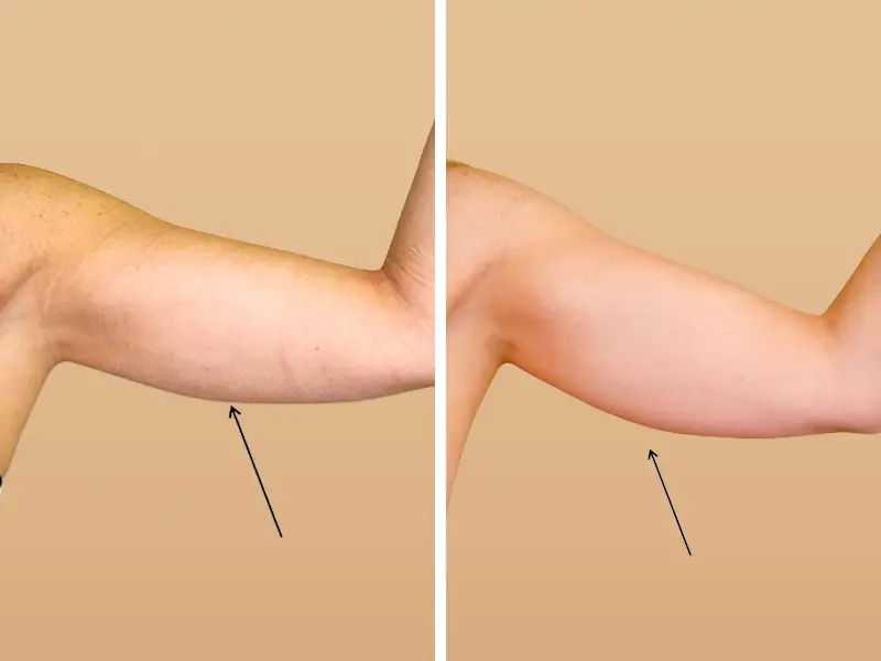 Before & After 1